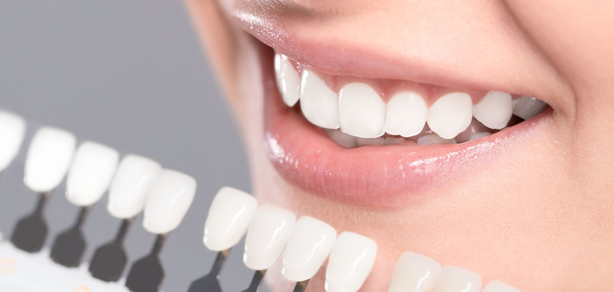Tooth Whitening kallangur| Teeth Whitening In Kallangur | Kallangur Dentist‎